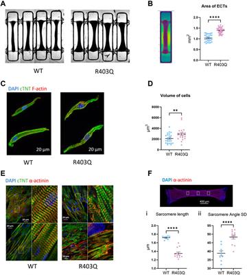 Human engineered cardiac tissue model of hypertrophic cardiomyopathy recapitulates key hallmarks of the disease and the effect of chronic mavacamten treatment